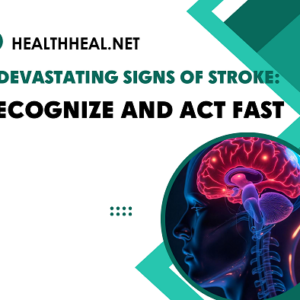 signs of stroke